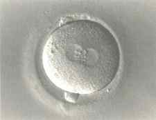 Γονιμοποιημένο έμβρυο Αυγερινός Αντώνης